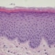 Human skin explant
